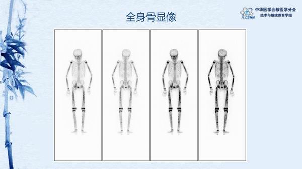 調(diào)整大小 7429eb7d192a4b74886be46d90dc2c9d.jpg