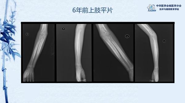 調(diào)整大小 fbaf1992086b4337b1d0cae8f8c34f9e.jpg