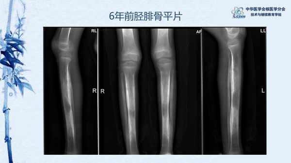 調(diào)整大小 01e53873713a4a2096f814fe8c65b70e.jpg