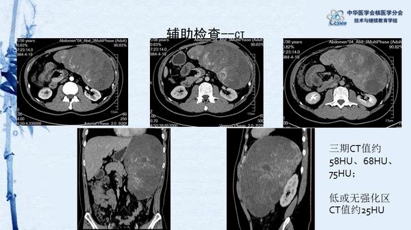 調(diào)整大小 4742d6615eb443d2a97a10f3b5f33eb0.jpg