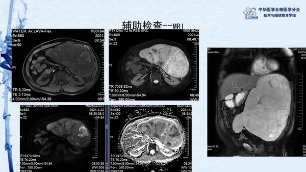 調(diào)整大小 f26c7e8da99b49979a86456d60a36a91.jpg