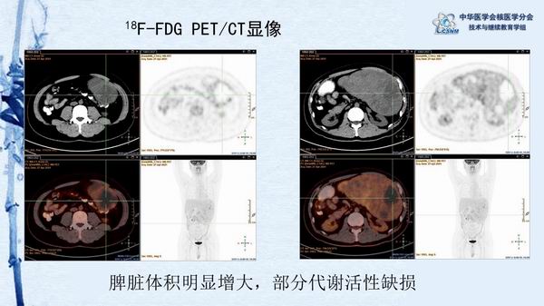 調(diào)整大小 3fcea6bb5f8a4c5faeb5d585ee79667e.jpg