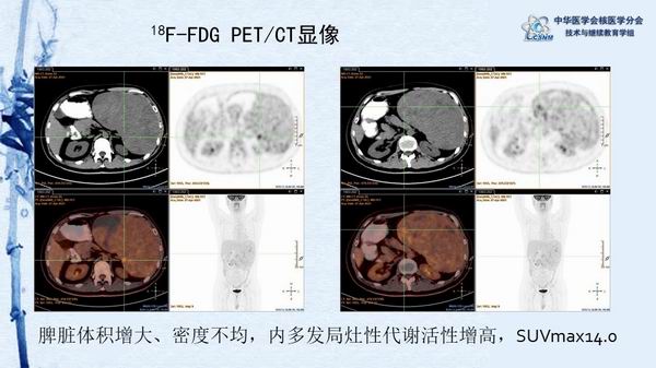 調(diào)整大小 f83962436a44470292c8eb3d60c8d426.jpg