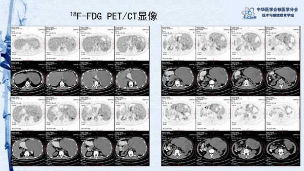調(diào)整大小 96cd77df6c7b4cbe8cf351dcaadfa1c0.jpg