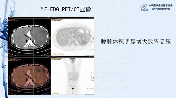調(diào)整大小 aa4f4aa883a04b2c855ab6b21ef4c0ac.jpg